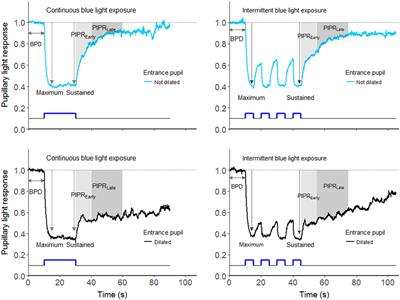 Effect of Intermittent versus Continuous Light Exposure on Pupillary Light Response, As Evaluated by Pupillometry